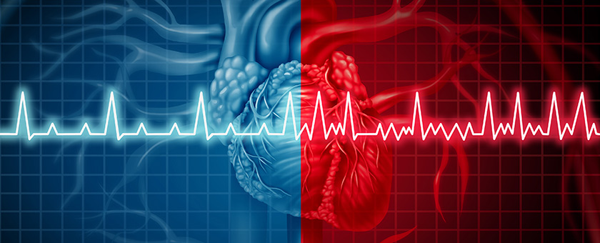 Eine technische Zeichnung eines Herzens mit EKG-Kurve.